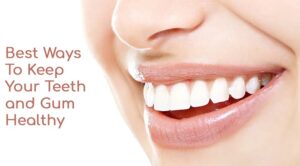 Teeth care tips | दात पिवळे आहेत.! चमकदार आणि मजबूत करण्यासाठी स्वयंपाक घरातील या वस्तूंचा उपाय करा, जाणून घ्या…