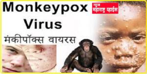 Monkeypox| कोरोनानंतर जगात मंकीपॉक्स आजाराची  दहशत ; अनेक देशात वाढत्या मंकीपॉक्सच्या रूग्णांमुळे चिंता